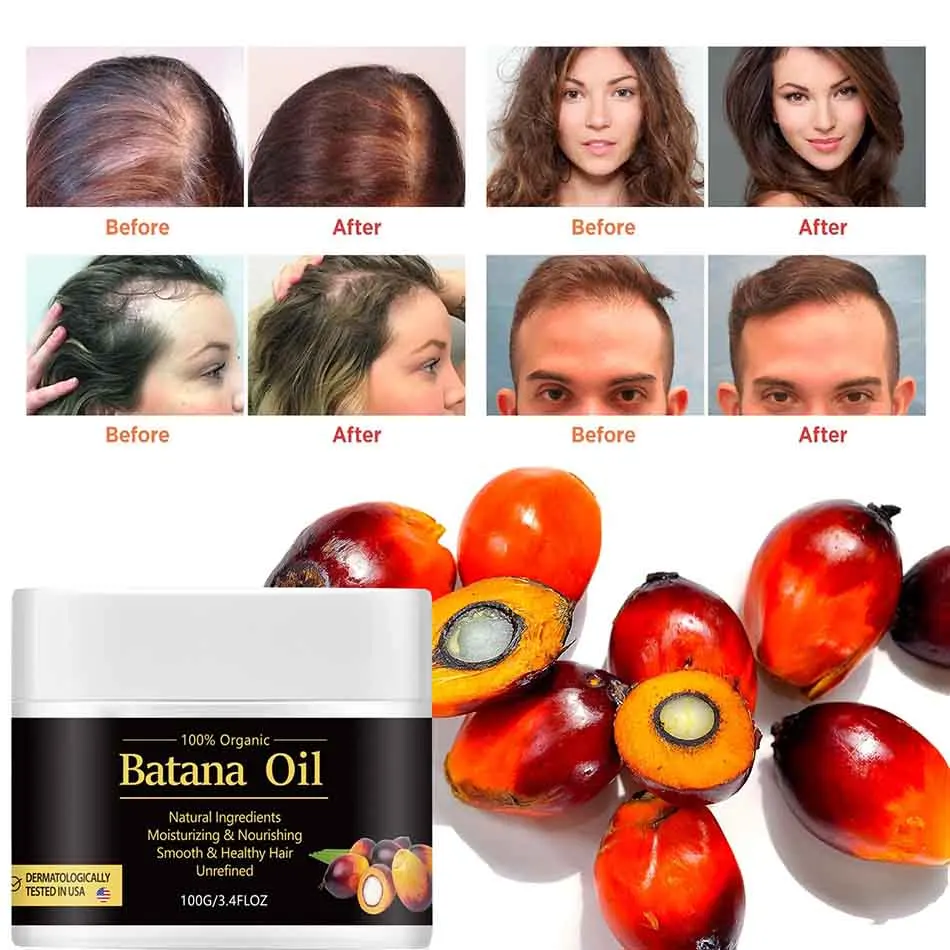 

100g Natural Batana Hair Growth Oil For Women 100% Batana Oil Hair Growth Oil Hair Regrowth Baldness Oil Hair Loss Treatment