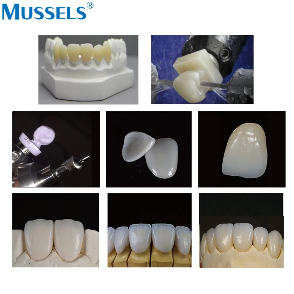 10 قطعة كتل ديسيليكات الليثيوم والسيراميك الزجاجي للأسنان C14 HT/LT/MT لـ CAD CAM Sirona Cerec القشرة تاج مختبر مواد طب الأسنان