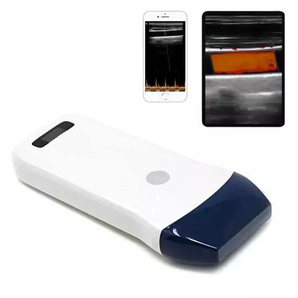 AC51-C Medical Handheld Ultrasound Scanner for Clinical Diagnostic musculoskeletal ultrasound machine Wireless Ultrasound Pro