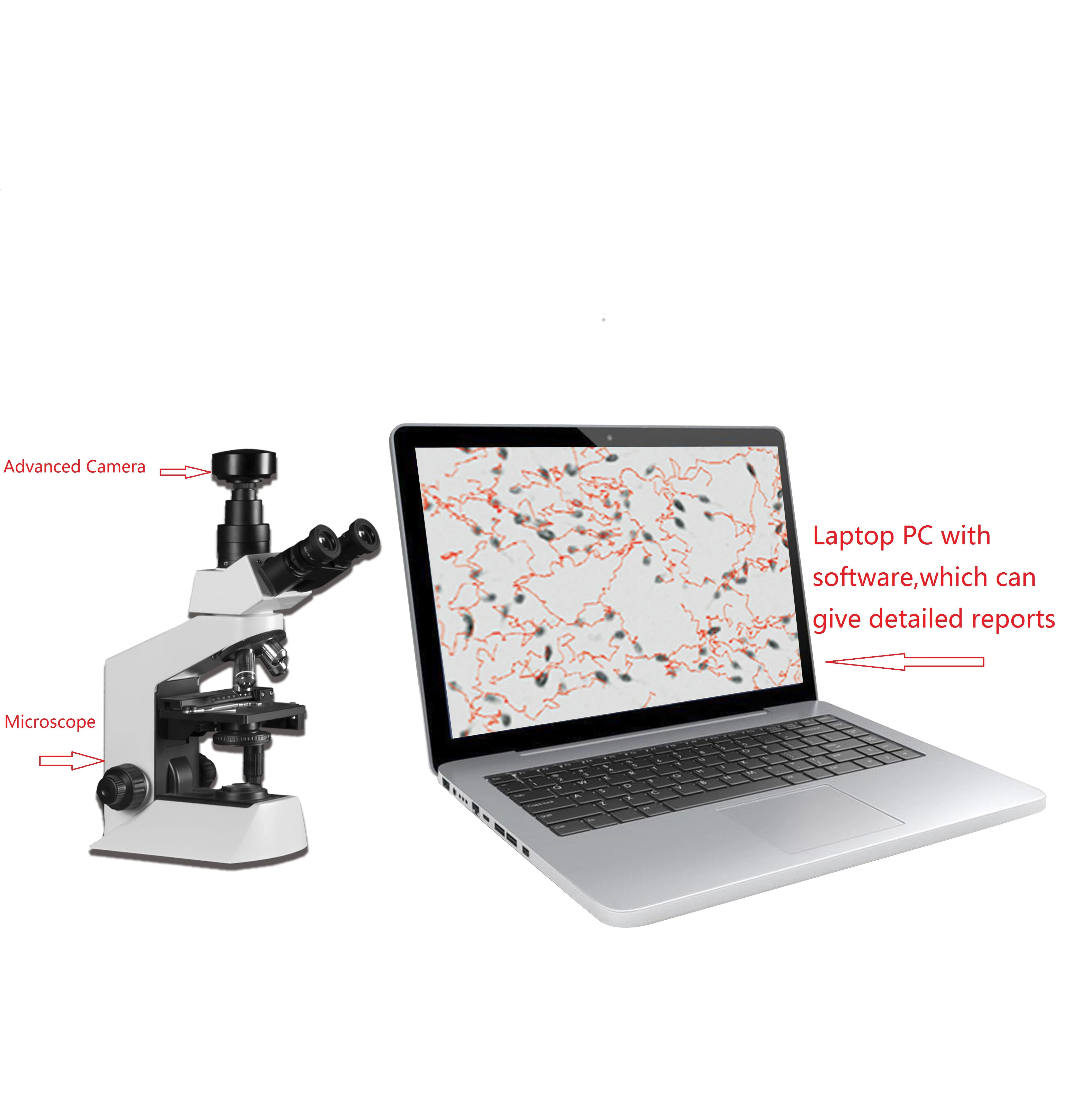 Computer Assisted Semen Analysis laptop automated sperm analyzer sperm analyzer microscope