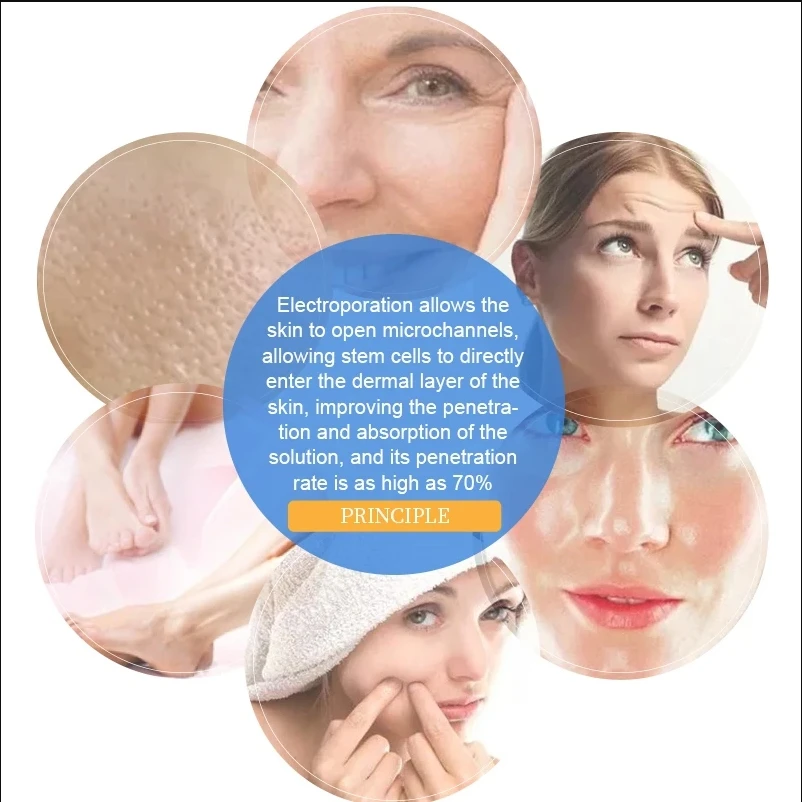 Máquina de cuidados faciais ems, máquina de beleza quente e fria, eletroporação, mesoterapia, antienvelhecimento, inchaço, máquina de rejuvenescimento da pele