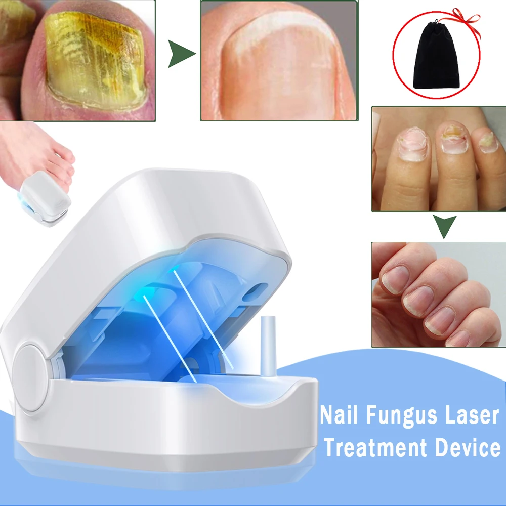 Nail Fungus Laser Treatment Device Repair Toenail Fingernail Fungus Treat Onychomycosis Therapy Cure Machine Effectively Remove