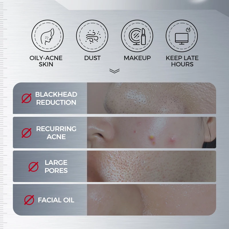 200ML Amino Acid Korean Facial Cleanser with Salicylic Acid Help with Pore Tighten, Acne & Blackheads
