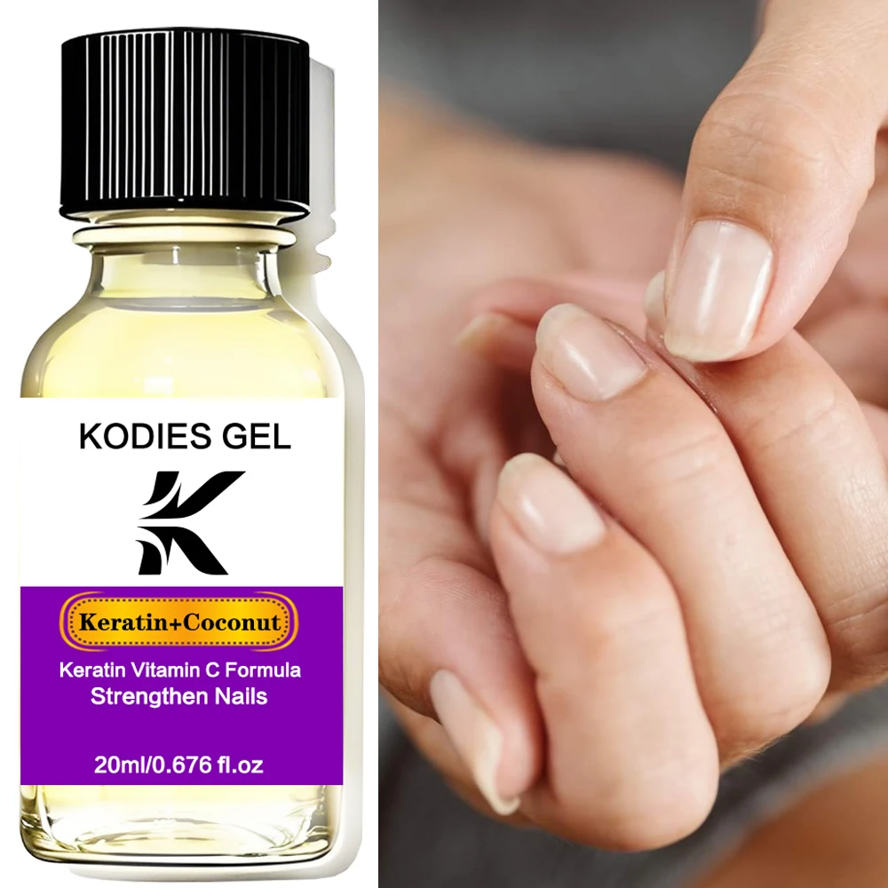 KODIES GEL Keratin Kokosnuss Nagelhautöl Stärkung der Nägel Vitamin C Formel Nail Art Behandlung Wachstum Verjüngung Öl Reparatur Nagel