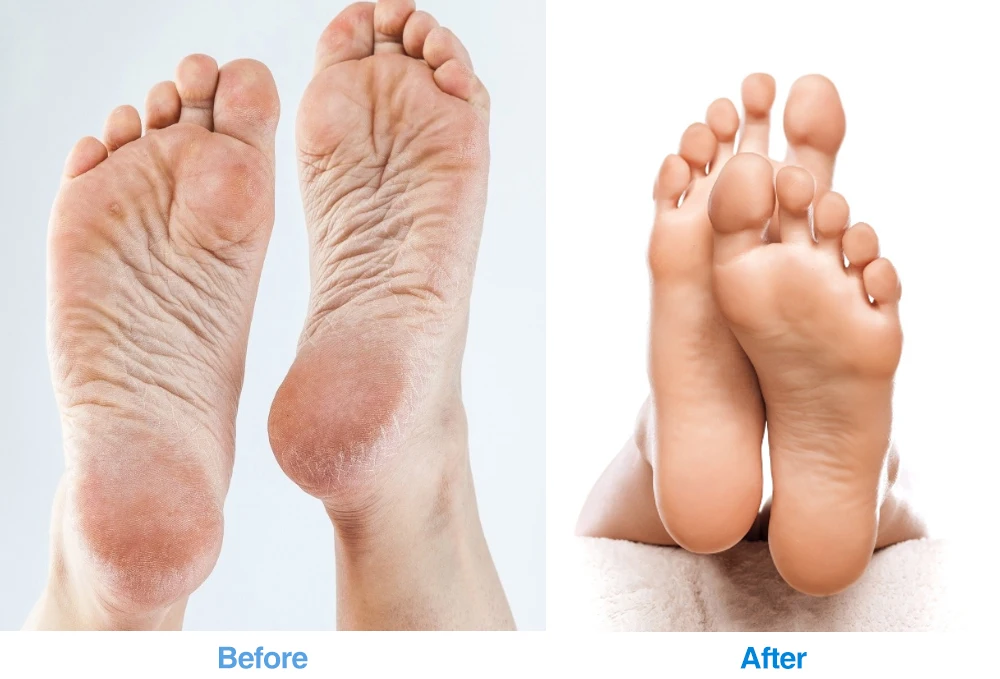 1 paar Siliconen Sokken & Handschoenen Voetverzorging Spa Pedicure Hiel Hydraterende Gebarsten Voet Protector Pijnbestrijding Dode Huid Verwijderen