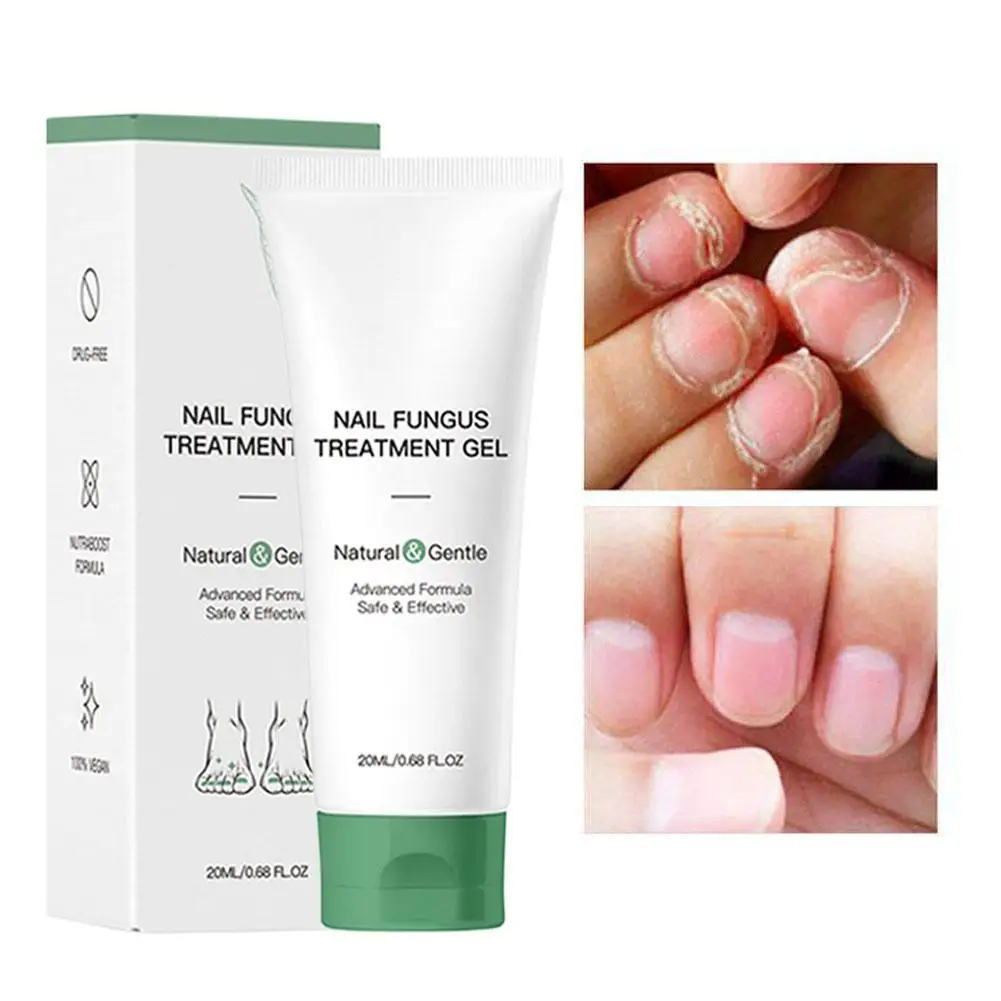 20ML Nail Repair Gel Foot Care Removal Repair Gel Natural Plant Formulas Foot Nail Fungus Essential Onychomycosis Nail Care