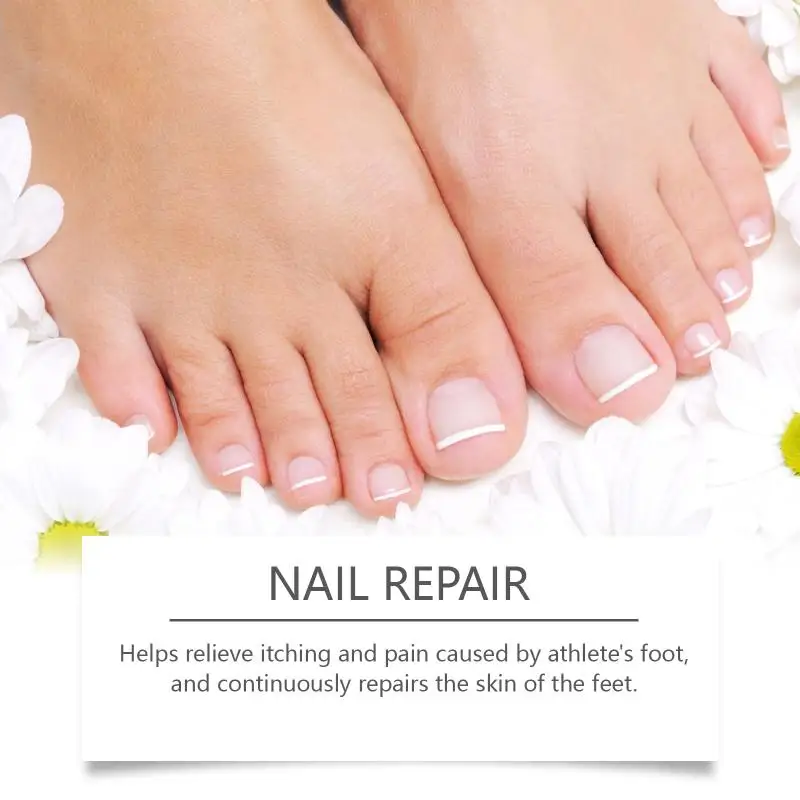 Nail Care Ointment Intensive Hydration For Hands Feet Softens Dry Cuticles 30g Daily Nourishing