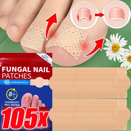 Parche para hongos en las uñas, parche impermeable para reparación de uñas, pegatina de corrección encarnada, parche para el cuidado de los pies, herramientas para el cuidado de los pies, 21/105 Uds.