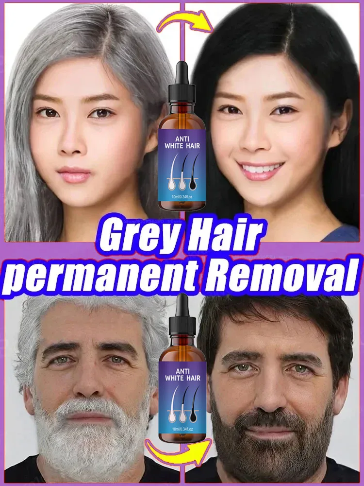 Natural Anti Gray Hair Serum Nourishing Hair Care Remedy Repair White & Darkening Hair