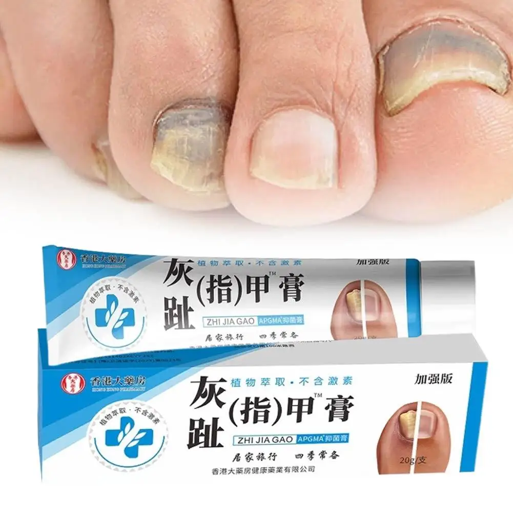 20g Nail Fungus Cream Non-New Bright Nail Fungus Clear Soft Nail Cream Toenail Repair Cream Foot Antiseptic Cream 2026 New