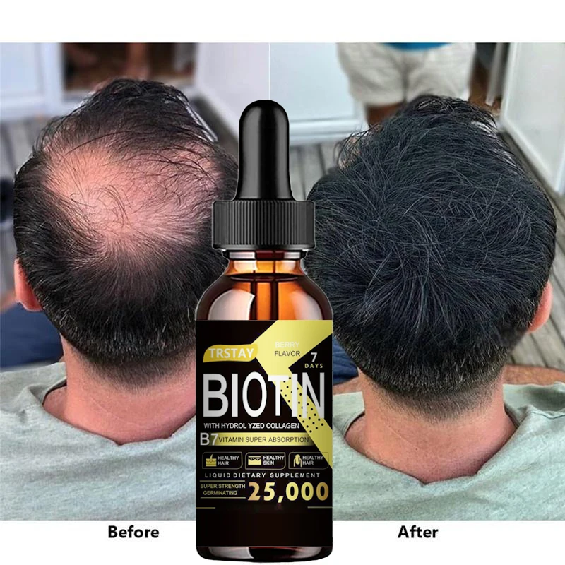 

Hair Growth Essential Oil Strengthen Hair Roots Anti Hair Loss Hair Care Head Care Essential Oils for Men Styling Appliances