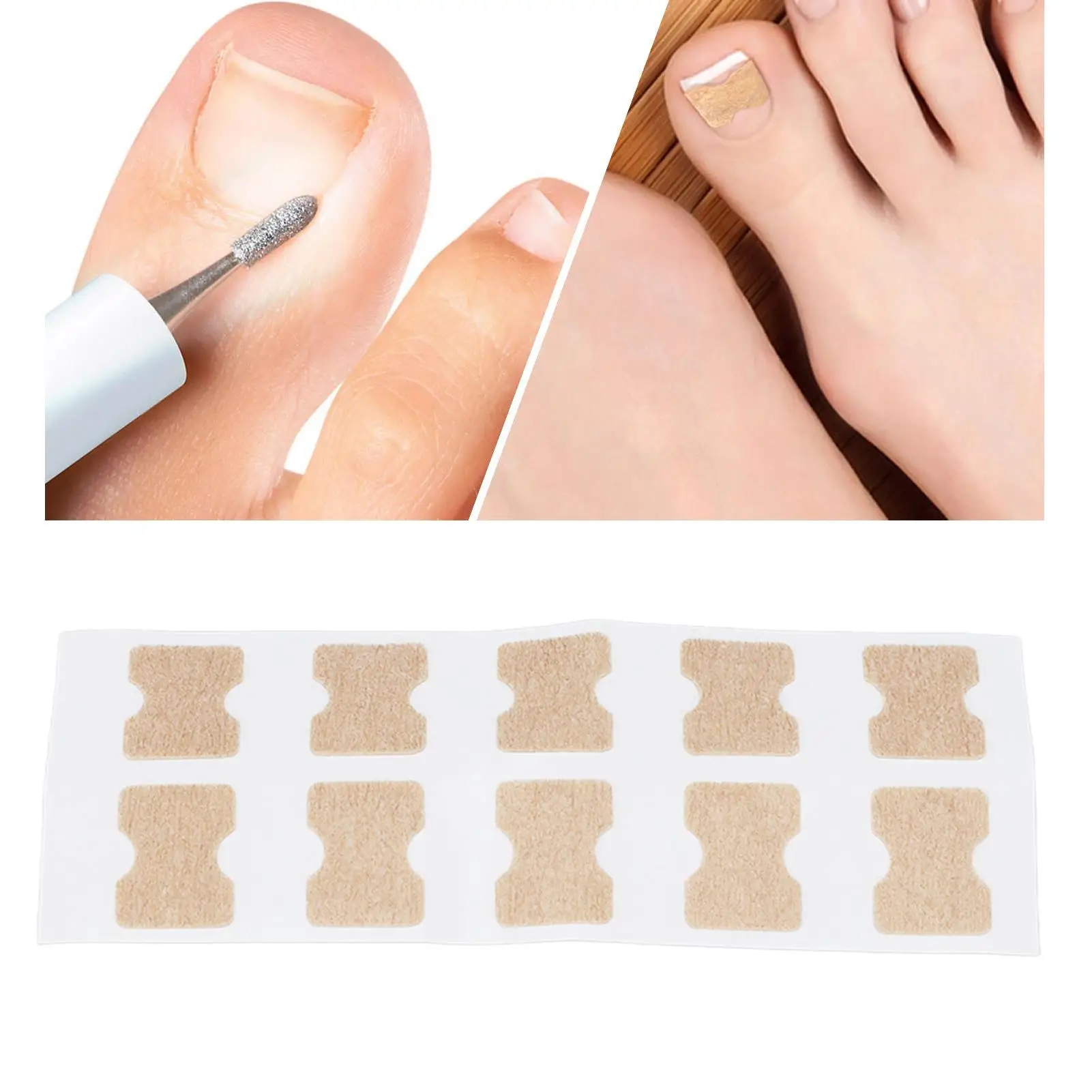 발톱 교정기용 통기성 탄성 스트립 내성발톱용 강력한 접착력 발톱 교정에 사용하기 쉬움