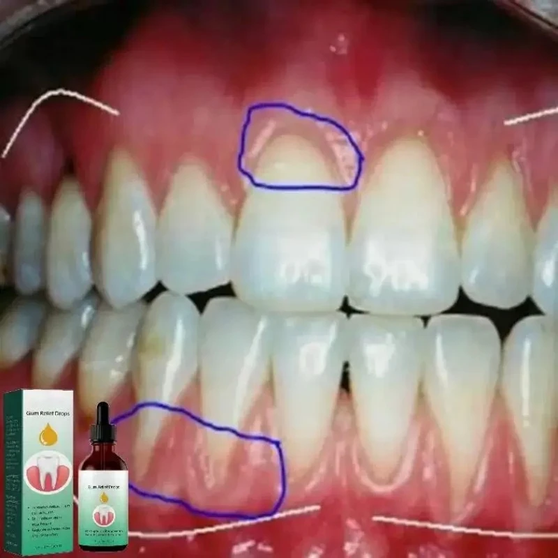 Tratamiento de la enfermedad de las encías, gotas de crecimiento Gingival, reparación de cavidades, Caries, tratamiento del dolor, mal Breat,