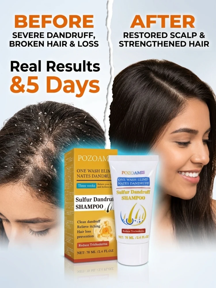 Herbal Anti-Dandruff Shampoo, Help Relieve Scalp Itch, Strengthen Hair Roots, Reduce Hair Breakage & Hair Fall, Deep Clean Scalp, Balance Oil, Refreshing Scalp Care Liquid Shampoo for Men Women All Hair Types
