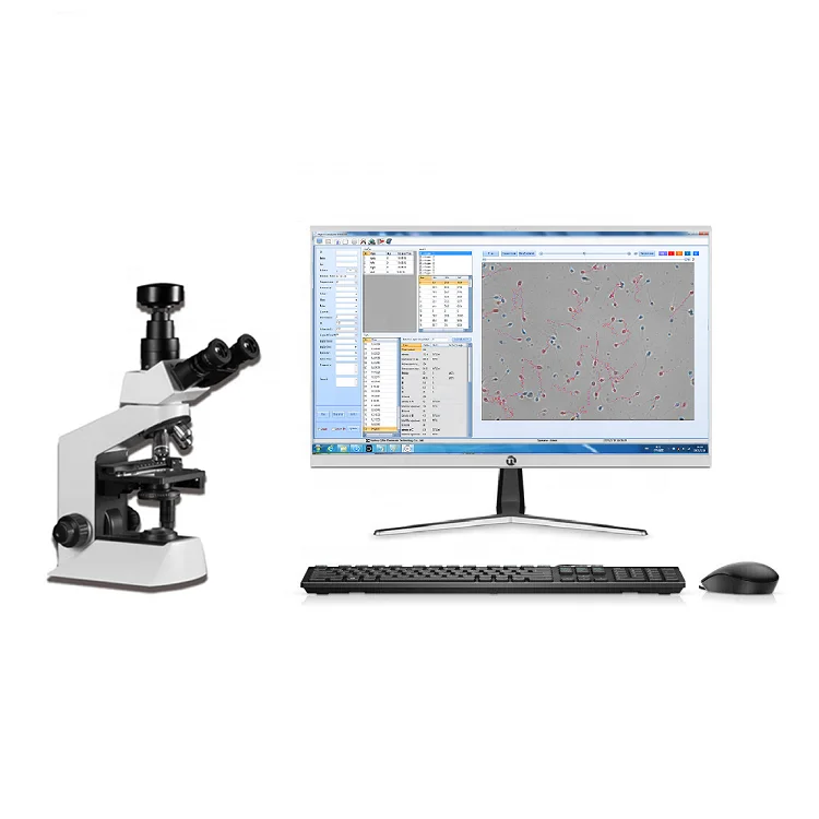 Veterinary sperm analyzer Bull   bull semen  for veterinary use animal  density count