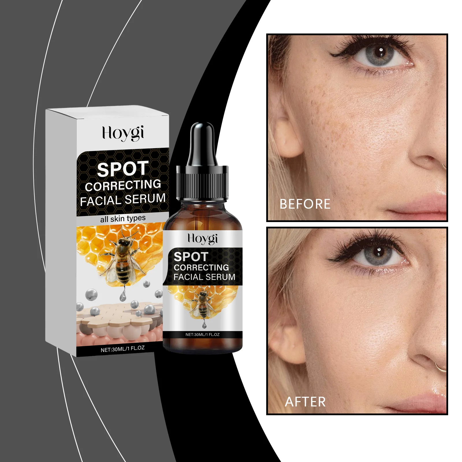 スポット コレクティング フェイシャル セラム - すべての肌タイプのダーク スポット リムーバーとブライトニング トリートメント