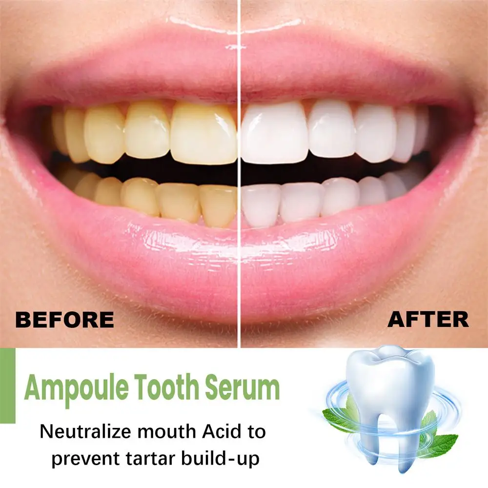 10PCS 3V TLOPA Ampoule Toothpaste Tooth Serum Ampoule Essence Toothpaste Fruit Acid Teeth Whitening Essence Tooth Care Essence