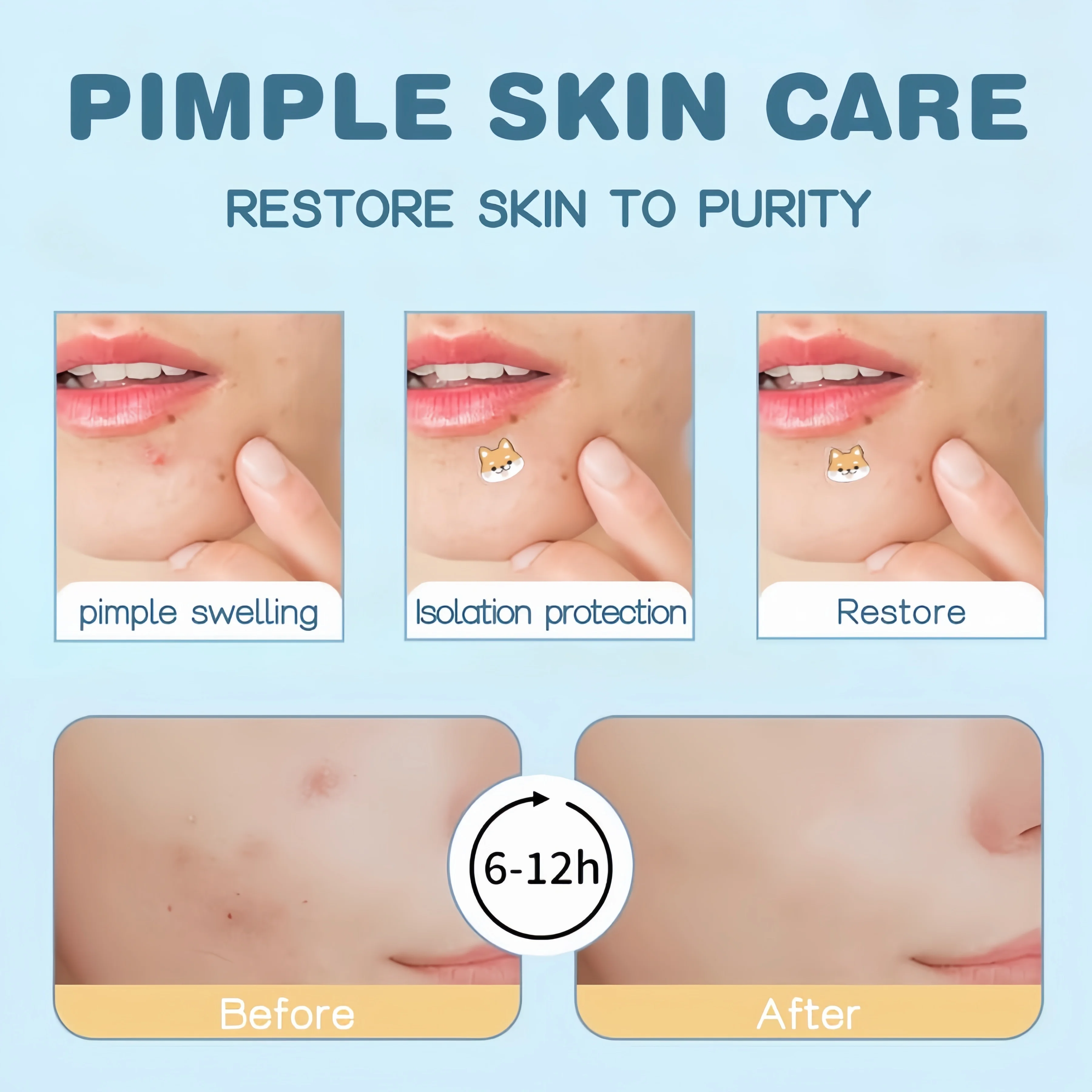 Parche para el acné de dibujos animados de 600 piezas, lindo parche para el acné corrector facial en forma de gato, seguro, no tóxico. Suave y no irritante.