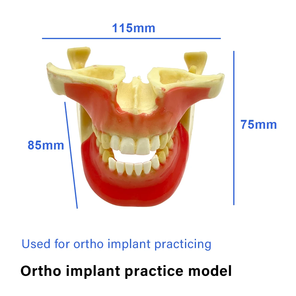 Ortho Implant Model Pathological Demonstration Ortodoncia Teeth Model Dental Study Model Teaching  for Student