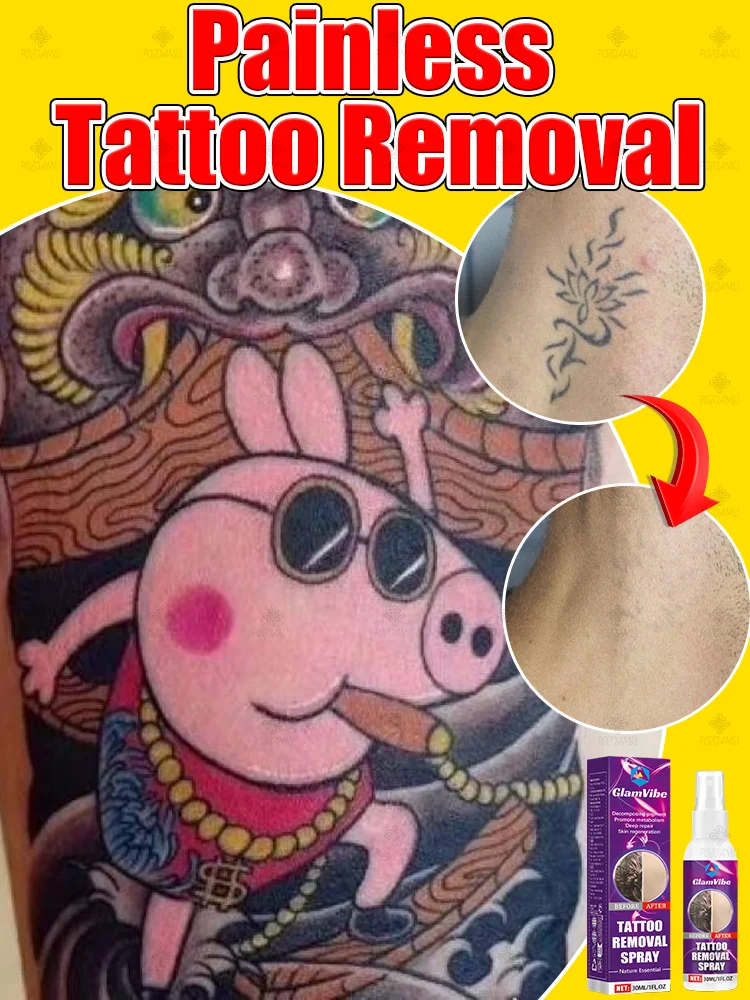 

fast Tattoo Remover Pigmented Permanent Makeup Tattoo Removal