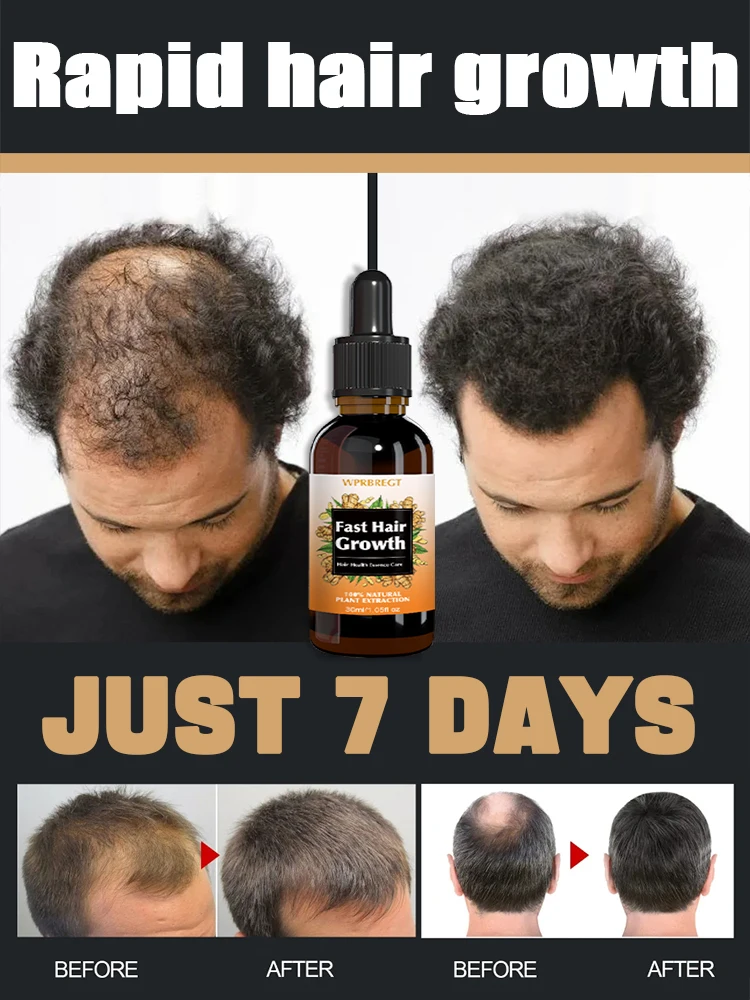 

98% of customers repurchase, have more and more hair, say goodbye to baldness