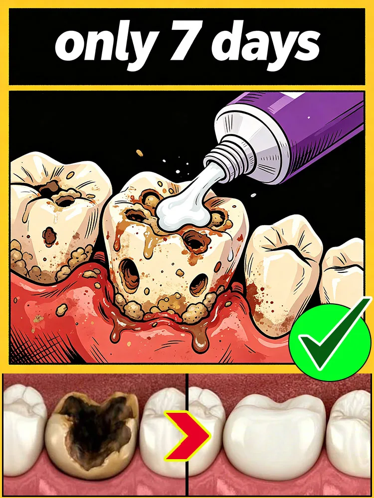 Plaque-removing toothpaste effectively cleans the tooth surface, provides oral care, freshens breath, removes stains, and brightens teeth.
