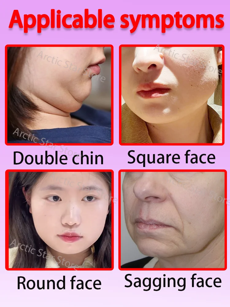 Double Chin V Shape Remove The face fat