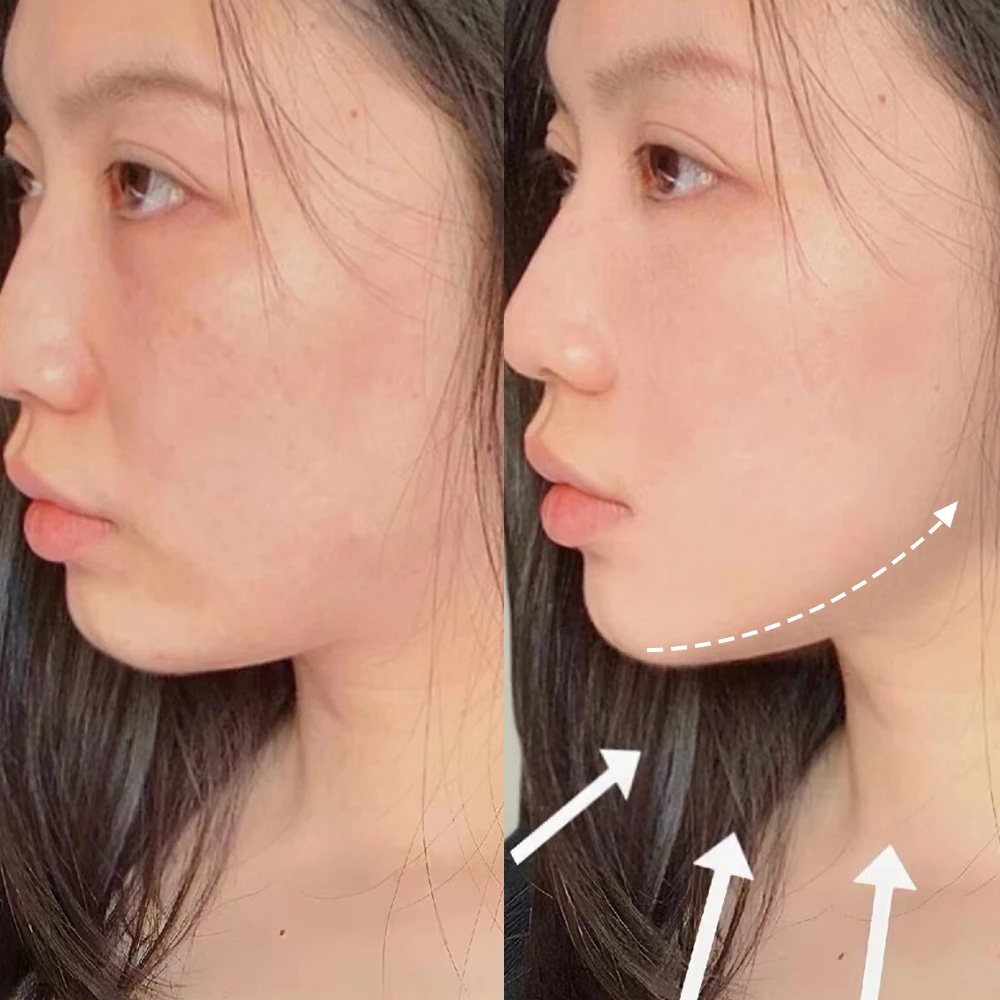 ذات الطابقين الوجه التخسيس ضمادة الوجه رفع حزام الخامس خط الوجه التخسيس حزام مزدوج الذقن المشدود سليم حزام قناع الوجه أداة