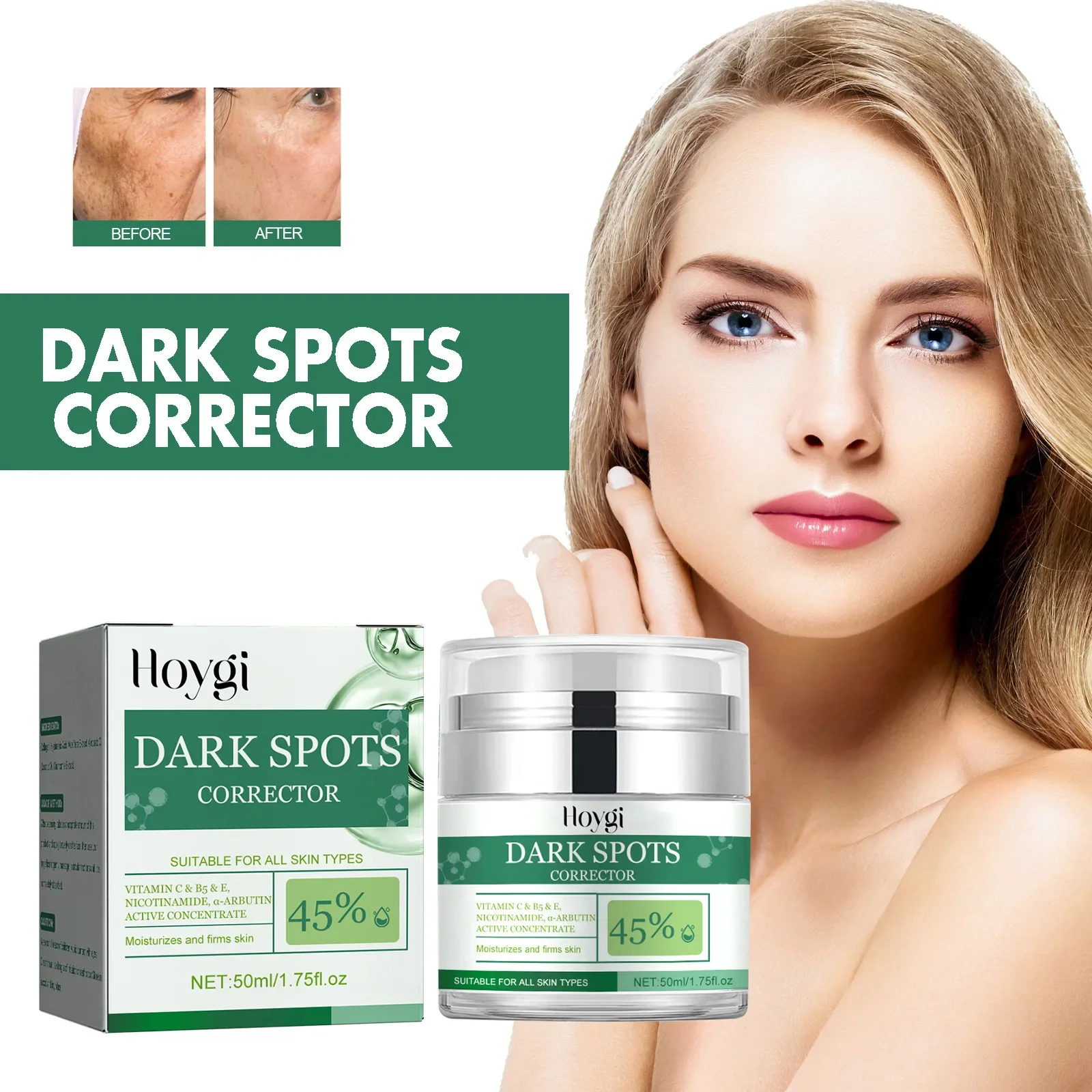 Hoygi Black Spot Correction Crème Hydraterende En Voedende Vervagende Huid Kleurvlekken Melanine Huidverjonging Verhelderende Crème