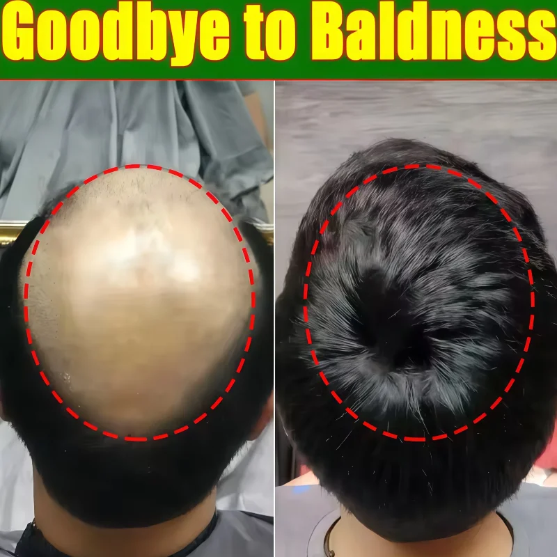 

Laser Cap for Thicker Fuller Hair 96 Beads LLLT Device Hair Regrowth Therapy Anti Hair Loss