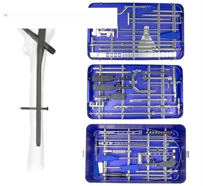 Orthopedic Implants  Femoral Intramedullary Nail Orthopedic Instrument Set Orthopedic Titanium Trauma Nail Implants