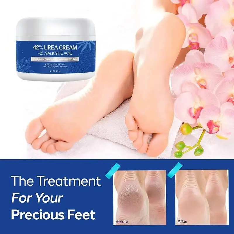 Urea Cream 42% Plus Salicylic Acid 4 Oz, Upgraded Callus Remover Hand Cream Foot Cream for Dry Cracked Feet, Hands,