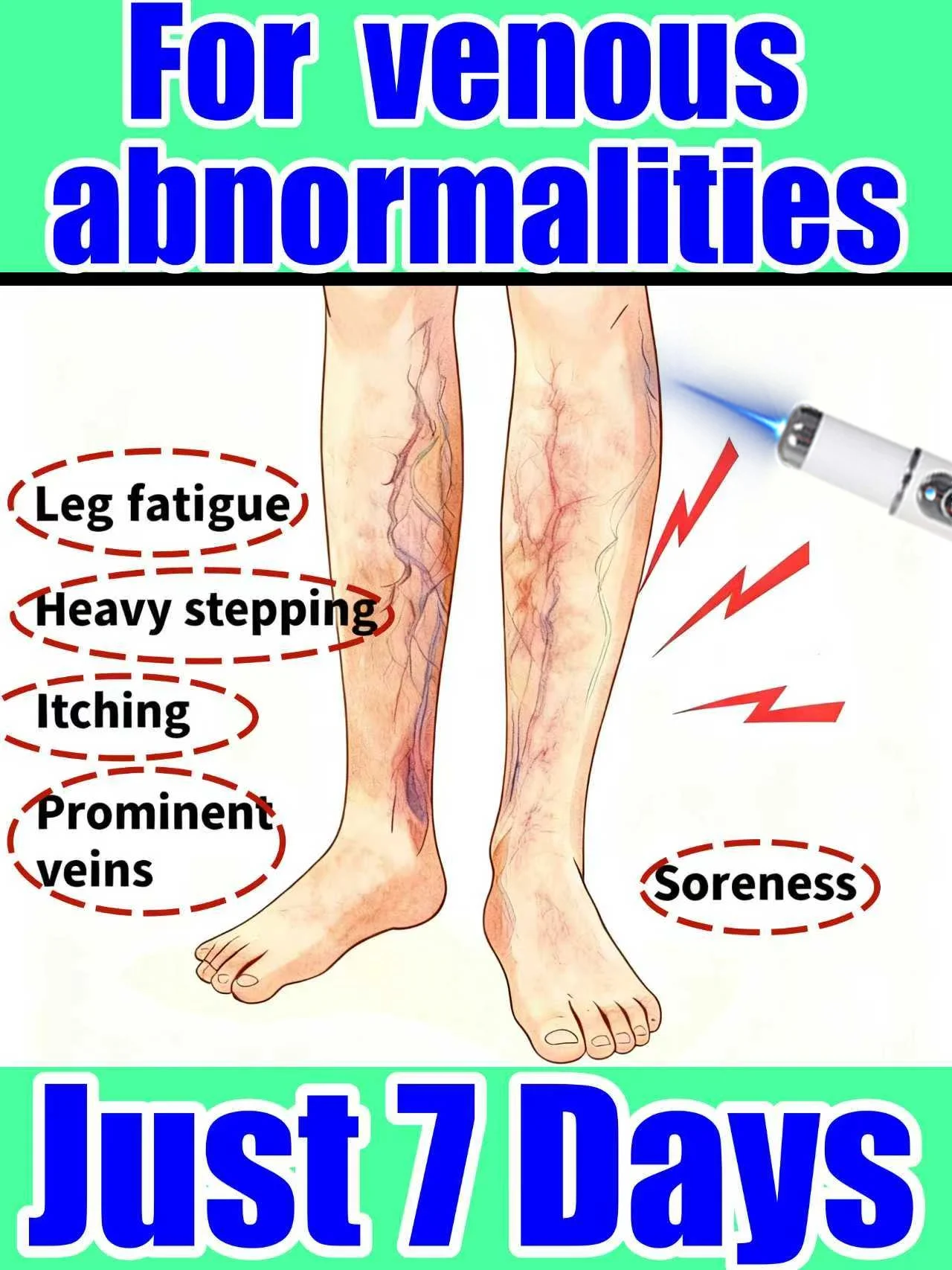 

New Year's Special: Genuine Leg Technology Set - Say Goodbye to Abnormal Leg Veins