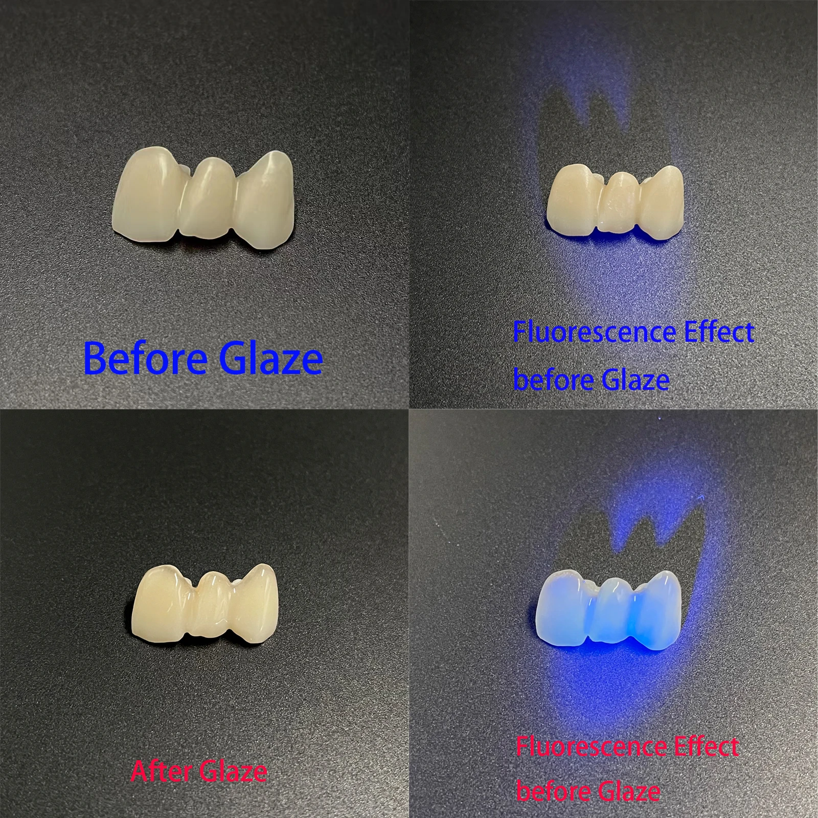 Lodden Multi-Color Dental Staining Glaze 4g Low Temperature Fluorescent Stains Aesthetic Set for Realistic Crown Effects
