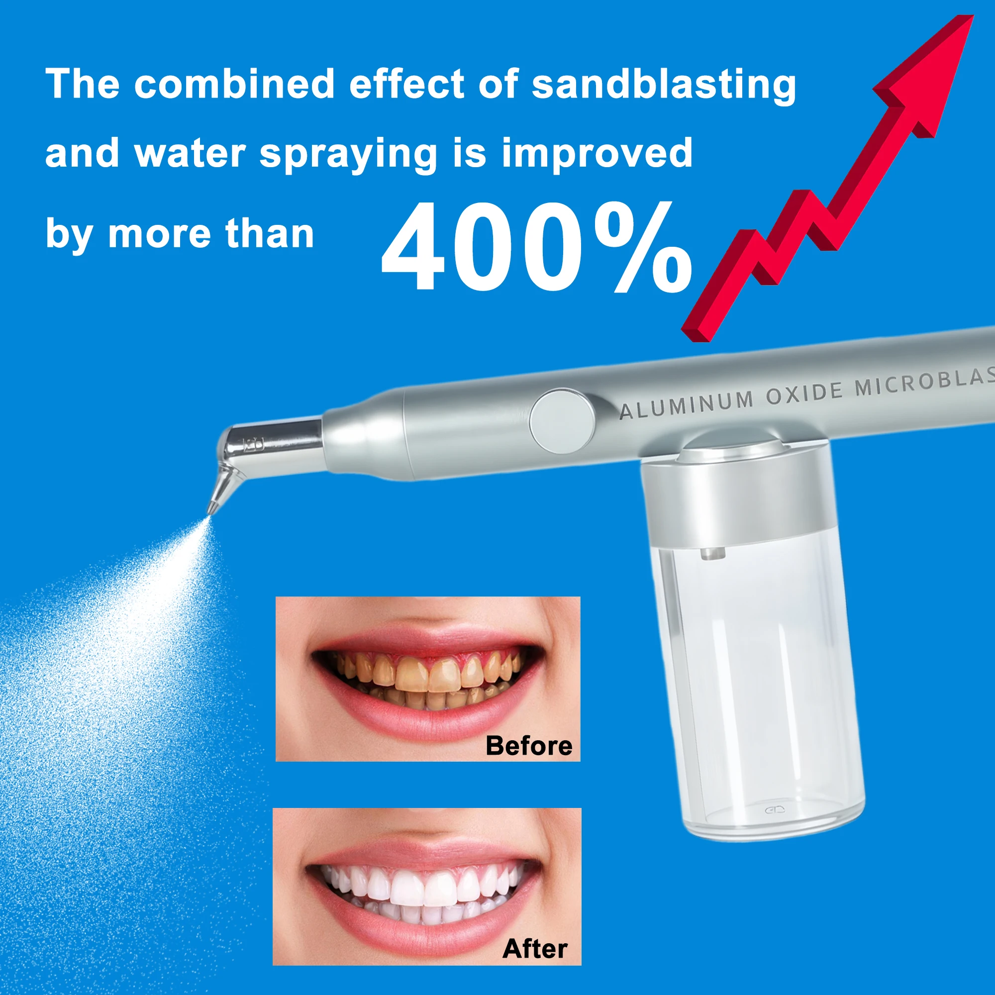 Dental Aluminum Oxide Micro Blaster Interface Microetcher Sandblasting Alumina Gun Air Abrasion Polisher Dentistry Tools