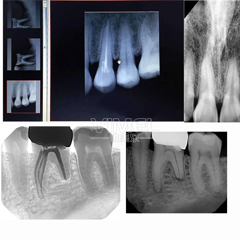 Dental X Ray Sensor Intra Oral RVG Digital Sensor With Holder for Dental Clinic Veterinary