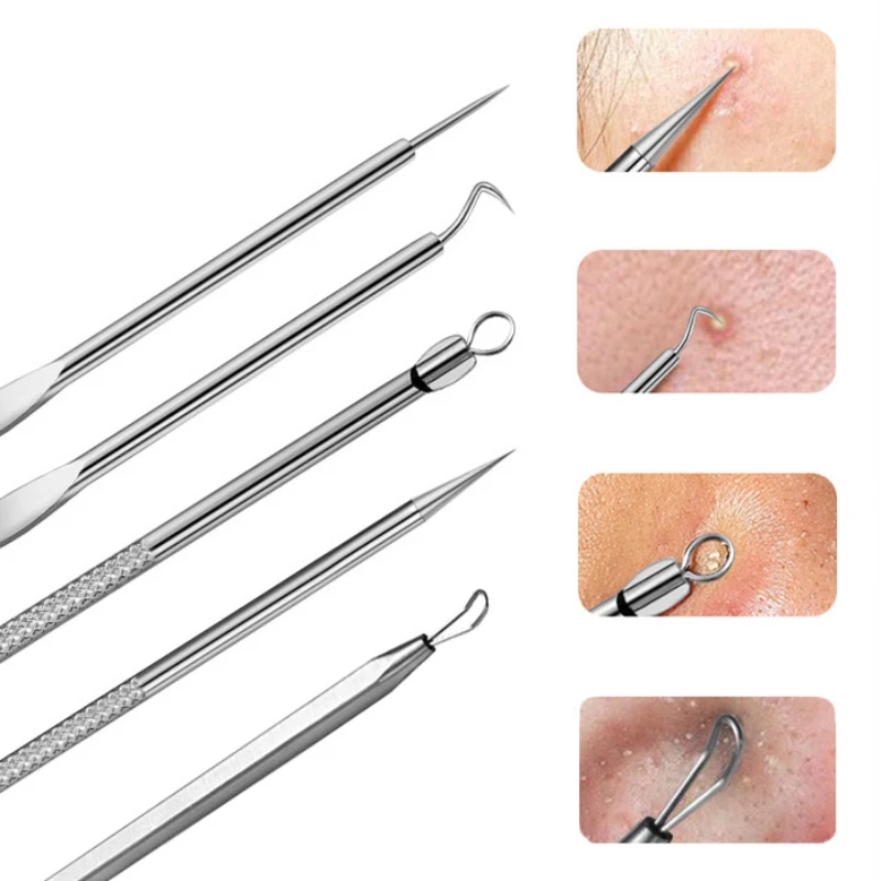 Niemiecki Ultra-fine No. Pęseta do usuwania zaskórników z 5 końcówkami, narzędzie kosmetyczne do twarzy, salonu, specjalny przyrząd do usuwania zaskórników, igła do trądziku.