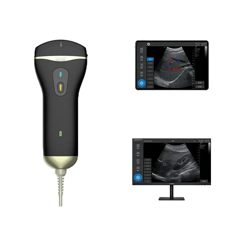 Amain Handheld USB Convex Probe Scanner Machine Clarius Prijs voor medisch gebruik