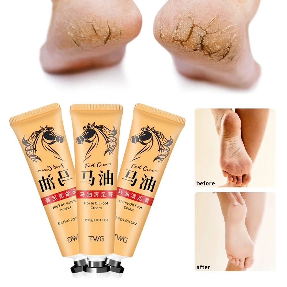 Anti Crack Foot Cream Heel Cracked Repair Horse Oil Cream Smooth Removal Dead Skin Callus Anti-Drying Hand Feet Skin Care 30g