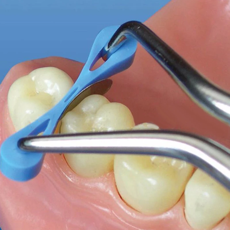 60 ชิ้น Dental Wedge Matrix เมทริกซ์ฟันแยกยางยืดหยุ่น Fixing Wedges 2.0/2.5 มิลลิเมตร Fit Into ใดๆ Interdental Space