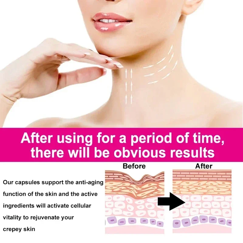 Collagen Capsules - Skin, Hair, Nails + Joint Care, Brightens Skin, Improves Melasma, Reduces Fine Lines, Rejuvenates New Cells