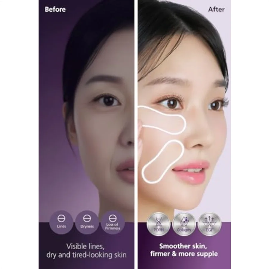 Easyderm PDRN بثرة التصحيح تحت العين ابتسامة خط الرعاية 4 بقع KBeauty العناية بالبشرة مع الكولاجين EGF العناية بالبشرة الكورية #3