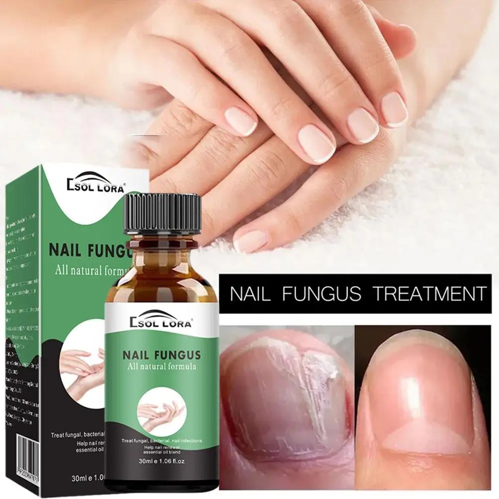 Sérum de réparation des ongles décolorés endommagés aux scanner, essence de bain renforcée, solution rapide N64.Solution, anti-Bri, Y2H6