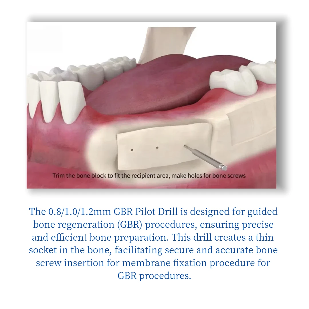 Dental GBR Bone Screw Drill Pilot Drill φ0.8/1.0/1.2 Cortical Perforate Twist Drill Pre-Drilling Guided Bone Regeneration