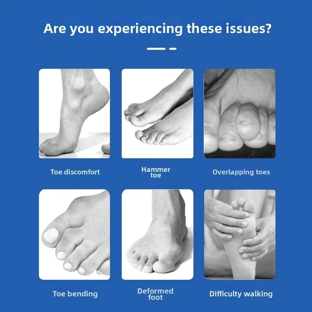 Soft Toe Corrector Blue Breathable Toe Fracture Fixator Orthotics Comfortable Foot Bone Thumb Adjuster Correction for Foot Care