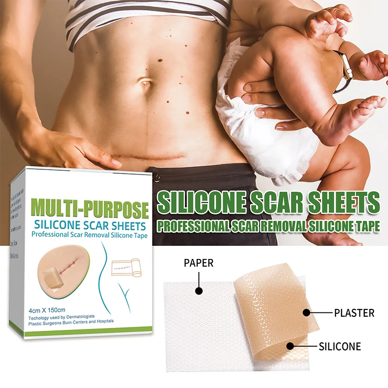 4X150CM Silicone Scar Patch Skin Repair Sheets Removal Self-Adhesive Stretch Marke Burn Acne Scar Tape Skin Care Tool