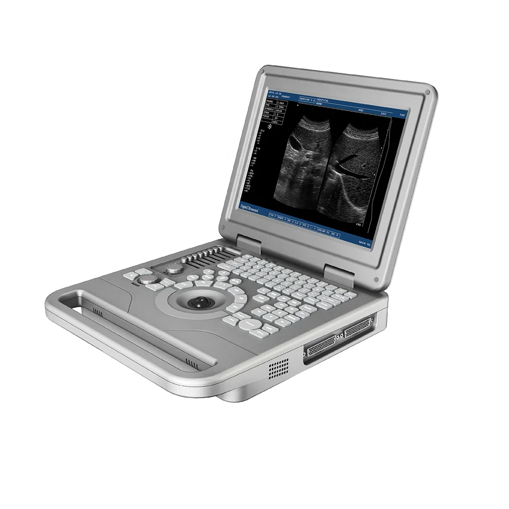 

LTUB77 Medical Ultrasound Instruments Portable Full Digital Human USG Ultrasound Machine