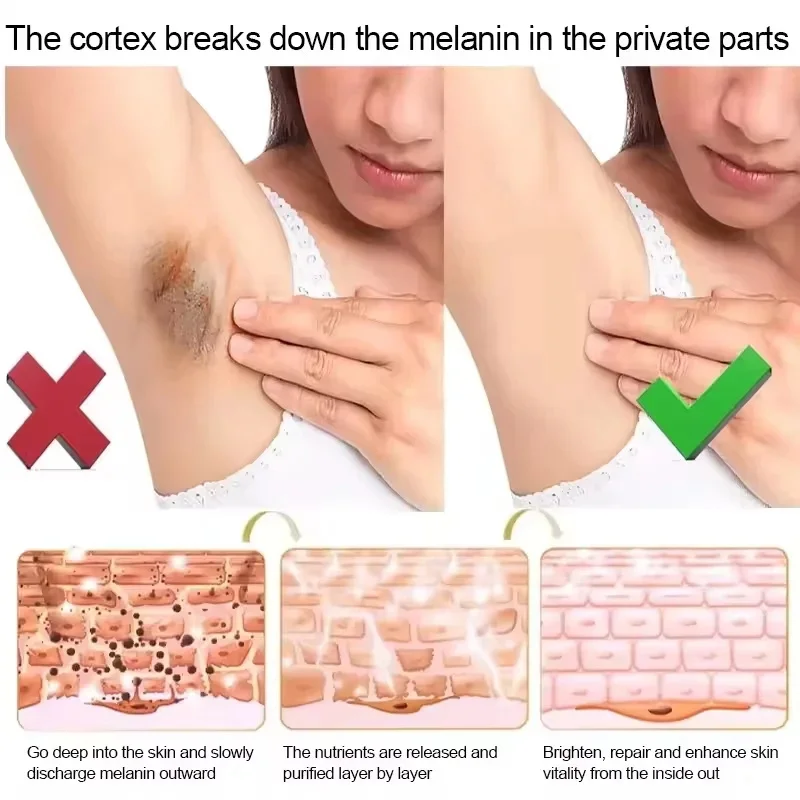 صابون تبييض الجسم تحت الإبط صابون تبييض الركبة إزالة جلد الدجاج إزالة البقع الداكنة الجلد الميت ترطيب سطع العناية بالجسم #4