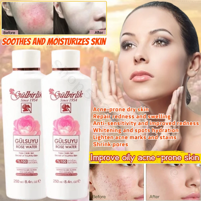 Water Damascus Rose Hydrosol Moisturizing and Brightening Skin Improves Dull and Dry Skin Toner Refines Pores 250ml