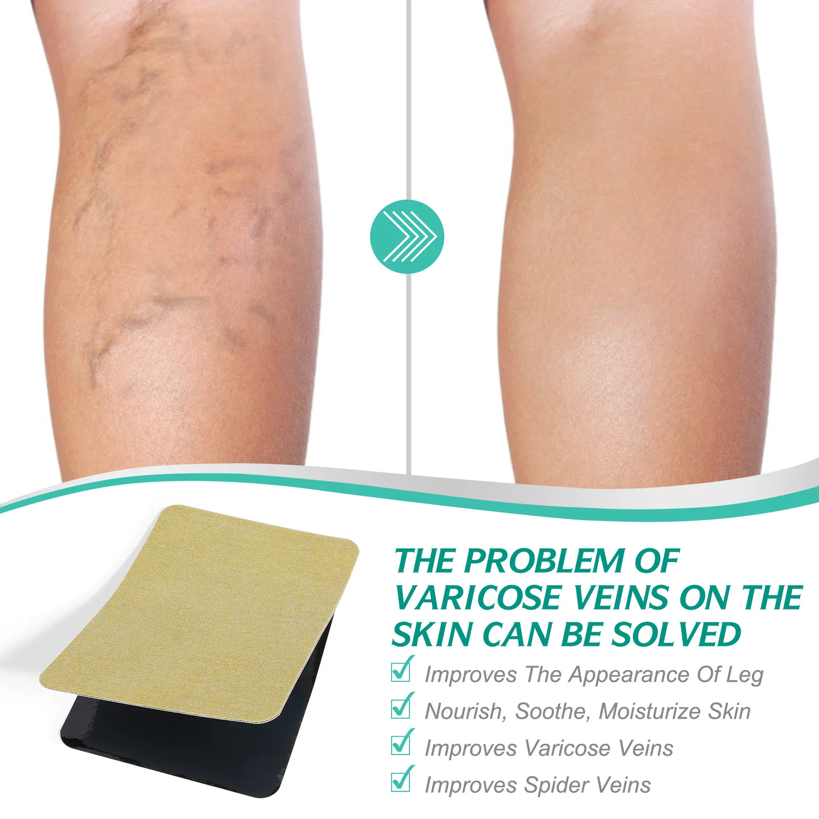 Patch de traitement des varices, plâtre pour les maux de jambes, favorise le métabolisme, favorise la Circulation sanguine lisse, 8 pièces